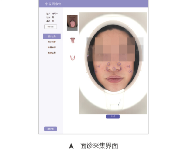 中醫(yī)四診儀01型（舌面脈信息采集管理系統(tǒng)）MT-SMT-01面診采集界面.png